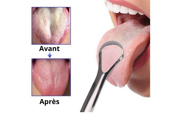 Correcteur de langue en Acier®