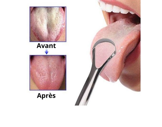 Correcteur de langue en Acier®